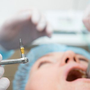 A patient undergoing dental implant surgery